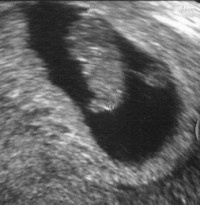 Larger sonogram